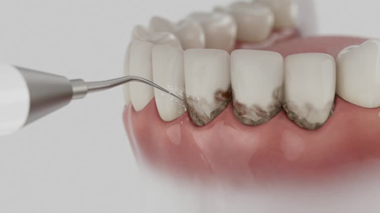 Trusted Teeth Whitening service in Phoenix, IL - Dentist Open Now
